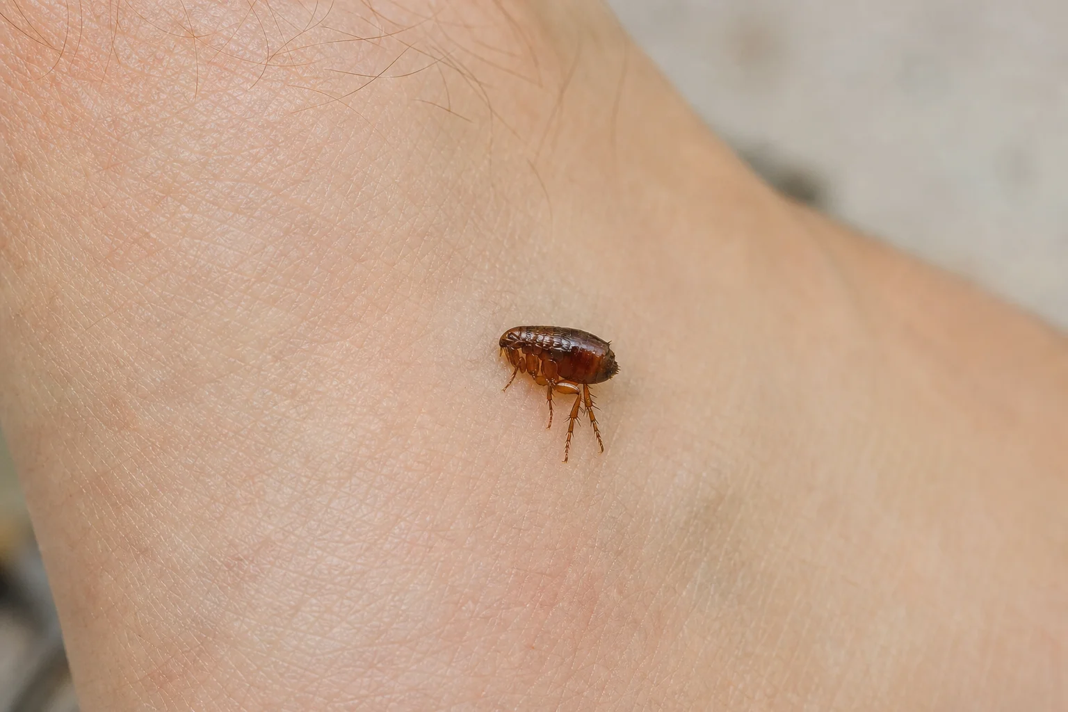 Macro view of a reddish-brown adult flea on human skin near the ankle
